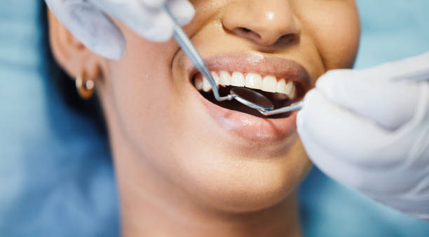 Dental Bonding in Grapevine, TX